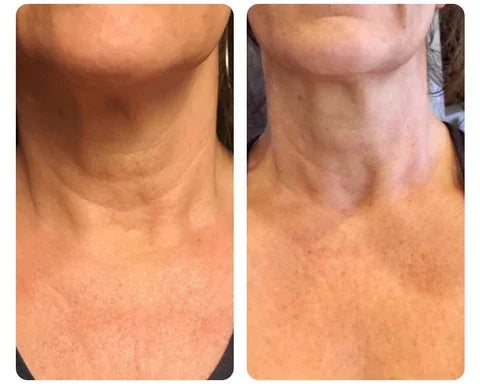 Hydrolized Collagen Neck Cream