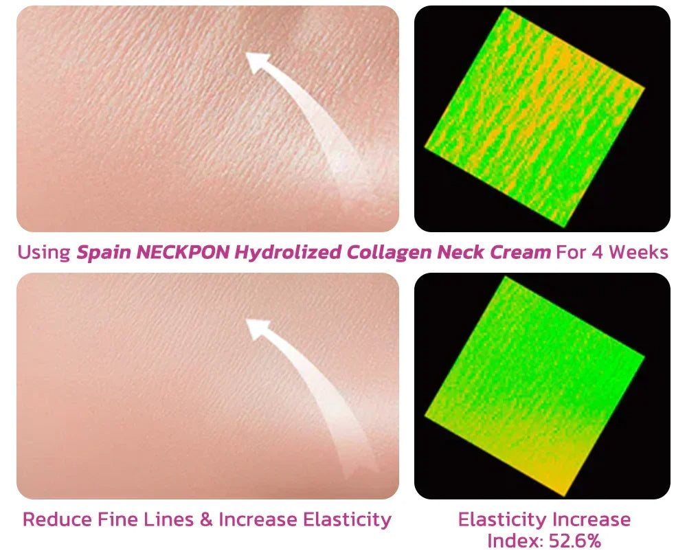 Hydrolized Collagen Neck Cream