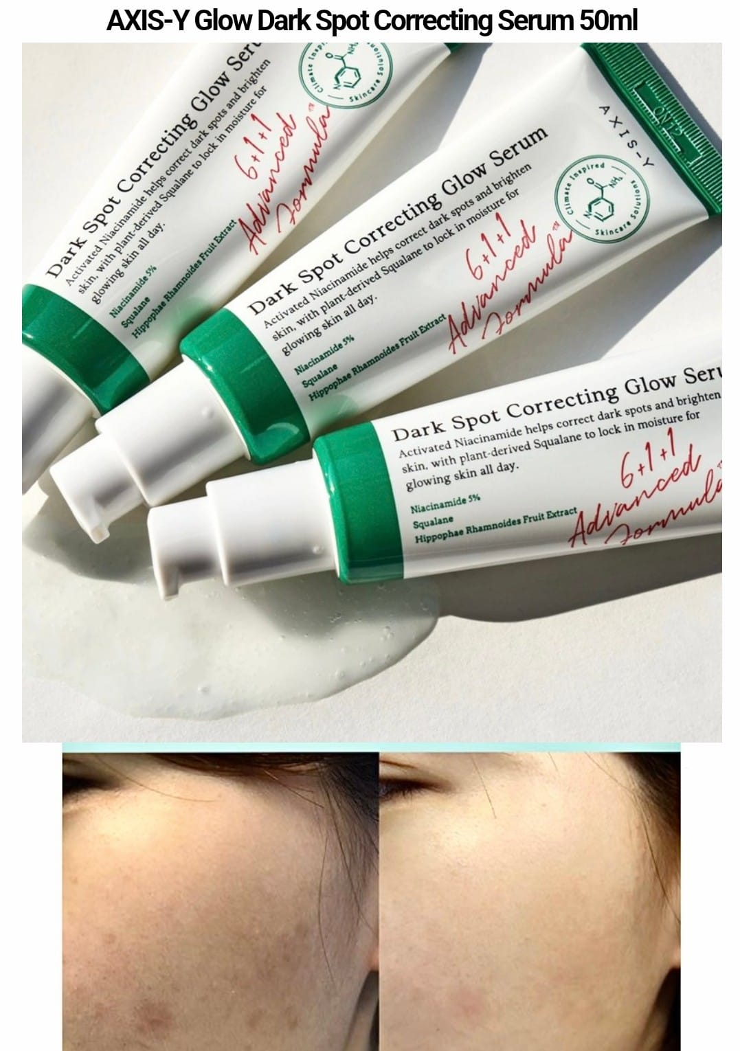 AXIS Y Dark Spot Correcting Glow Serum (50 ml) [FREE DELIVERY]