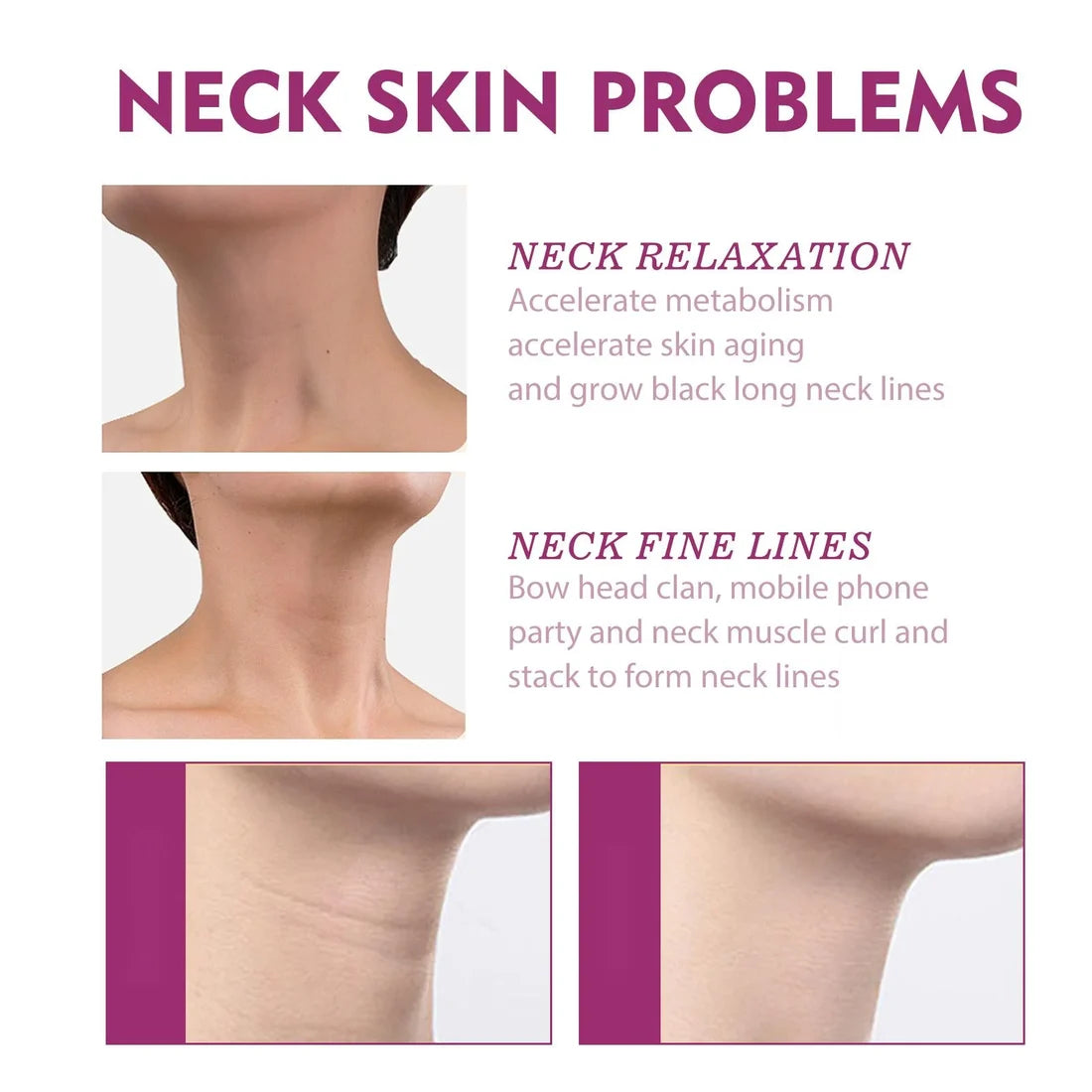 Hydrolized Collagen Neck Cream