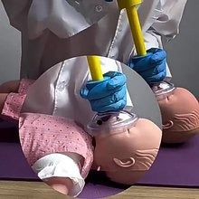 🆘 Automatic Choking Rescue Device for Kids/Adults